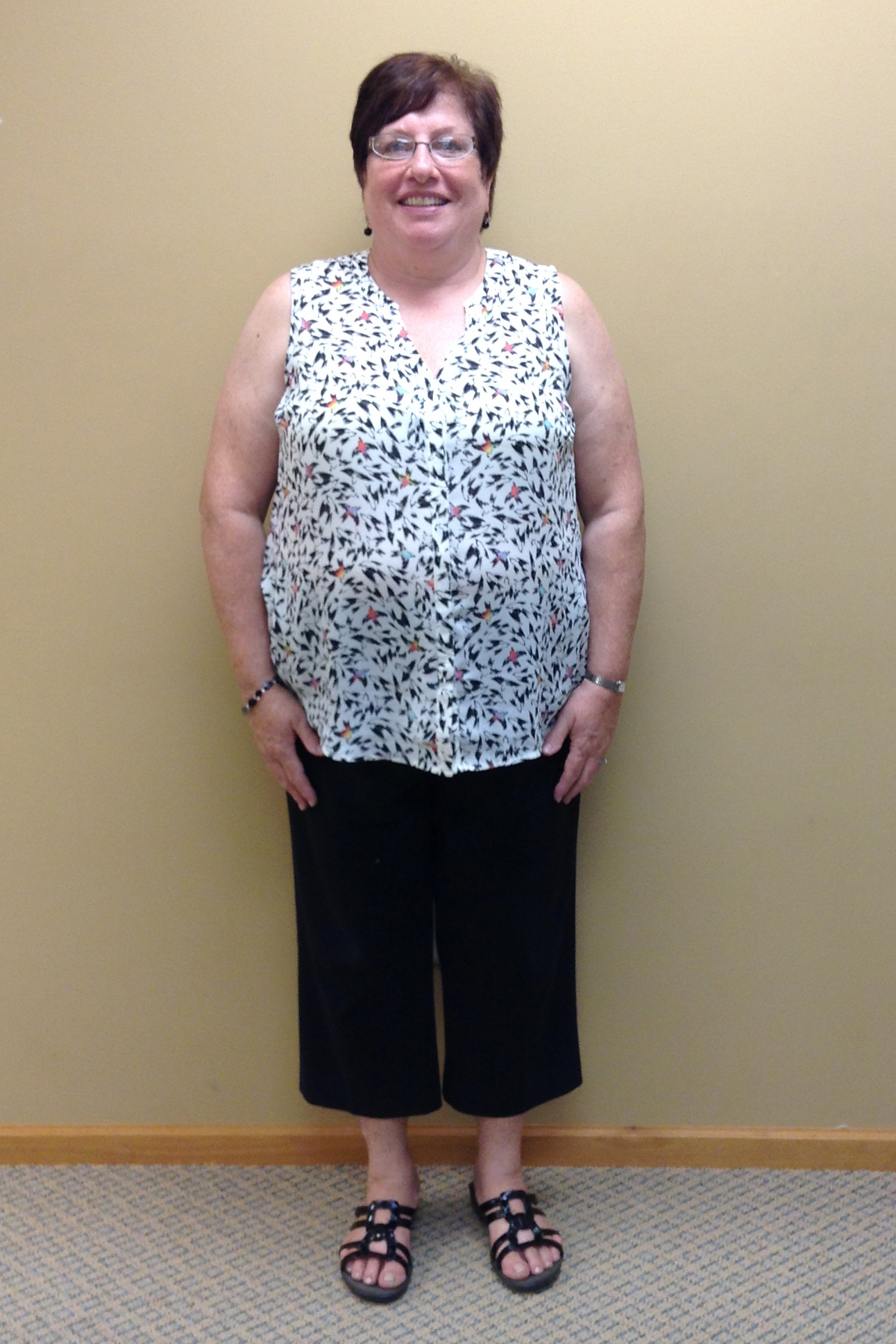 nuyou weight loss client vickie bain before