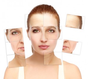 image of before and after skin rejuvenation treatments for skin laxity around mouth or marionette lines